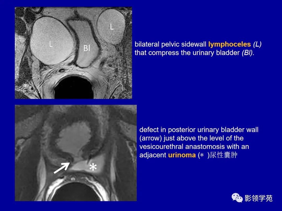 【PPT】前列腺癌MRI诊断再认识-165