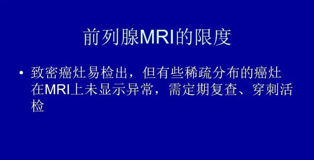 【PPT】前列腺癌MRI诊断再认识-173