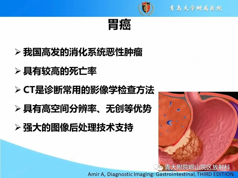 【PPT】CT对胃癌诊断和临床应用价值-3