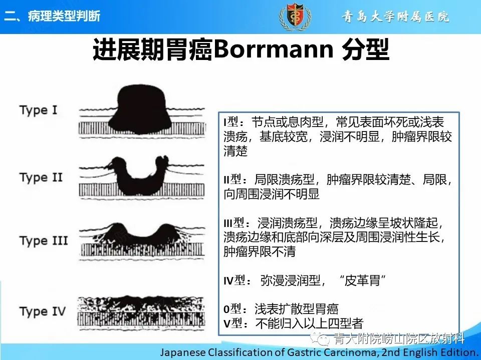 【PPT】CT对胃癌诊断和临床应用价值-13