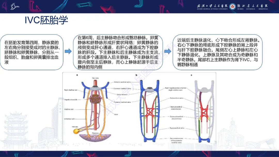 【PPT】下腔静脉解剖变异及病变影像诊断-4