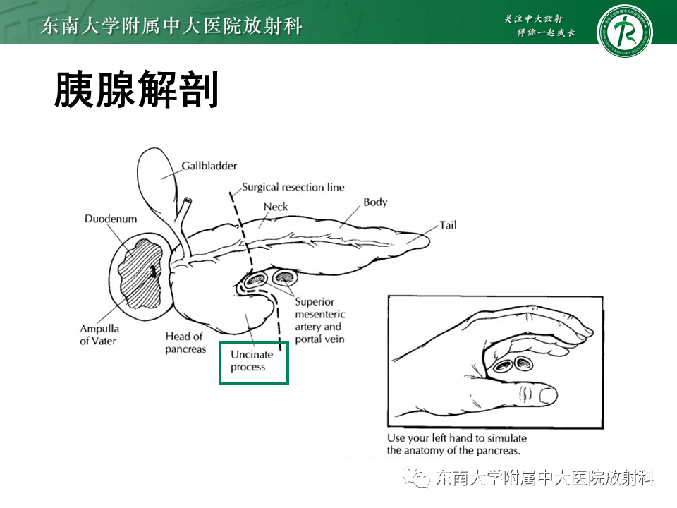【PPT】胰腺常见囊性病变影像表现-7