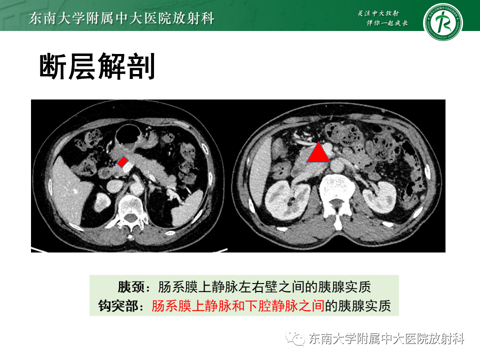 【PPT】胰腺常见囊性病变影像表现-8