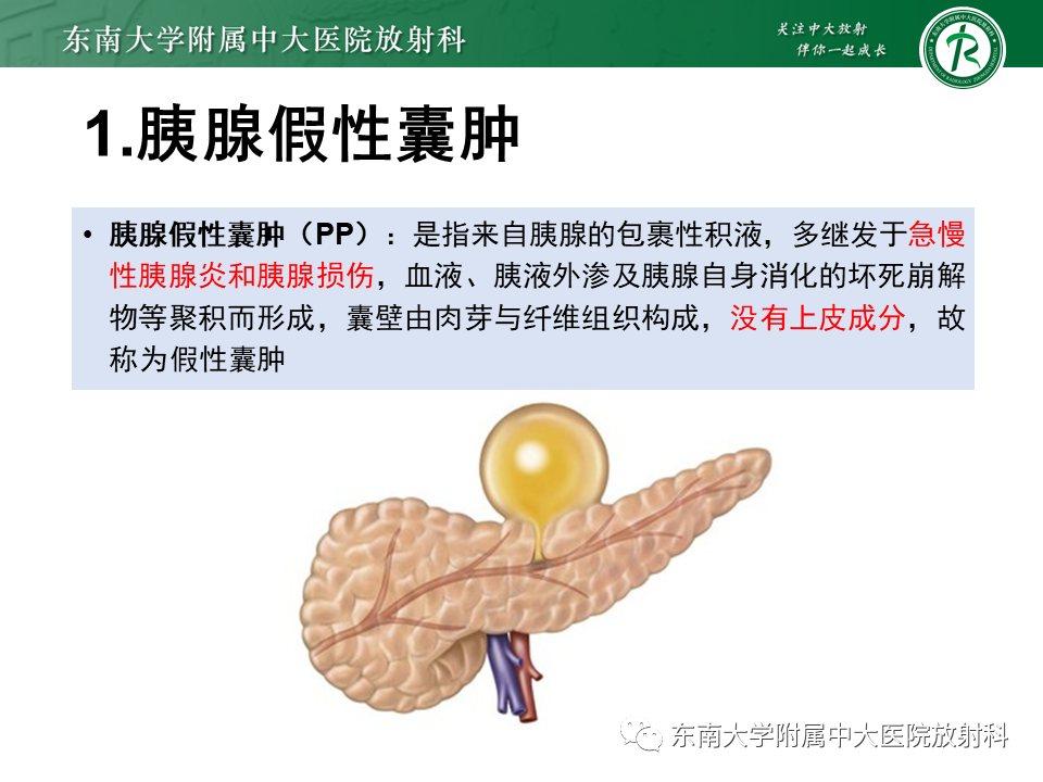 【PPT】胰腺常见囊性病变影像表现-13