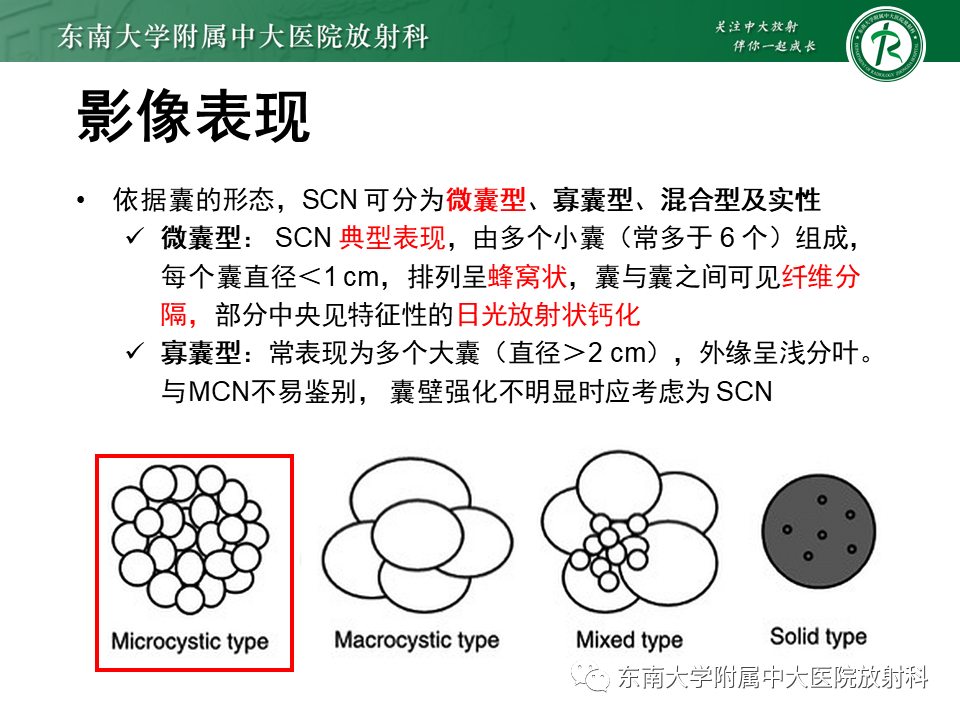 【PPT】胰腺常见囊性病变影像表现-18