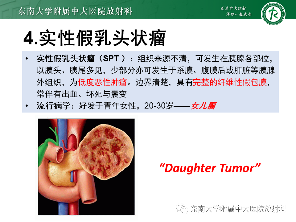 【PPT】胰腺常见囊性病变影像表现-29