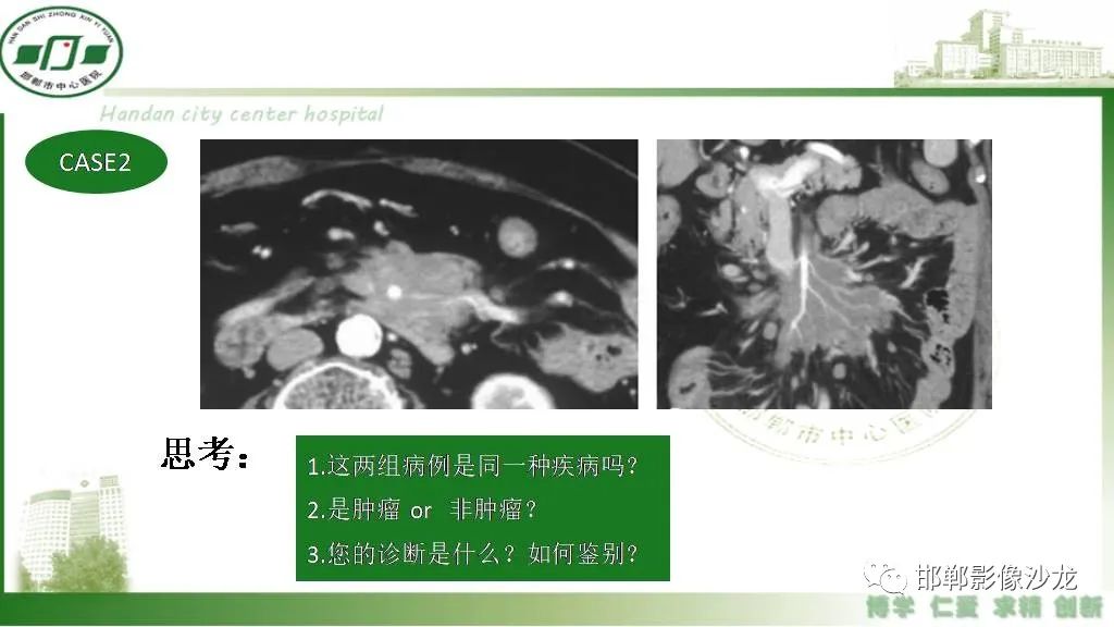 【PPT】硬化性肠系膜炎-3