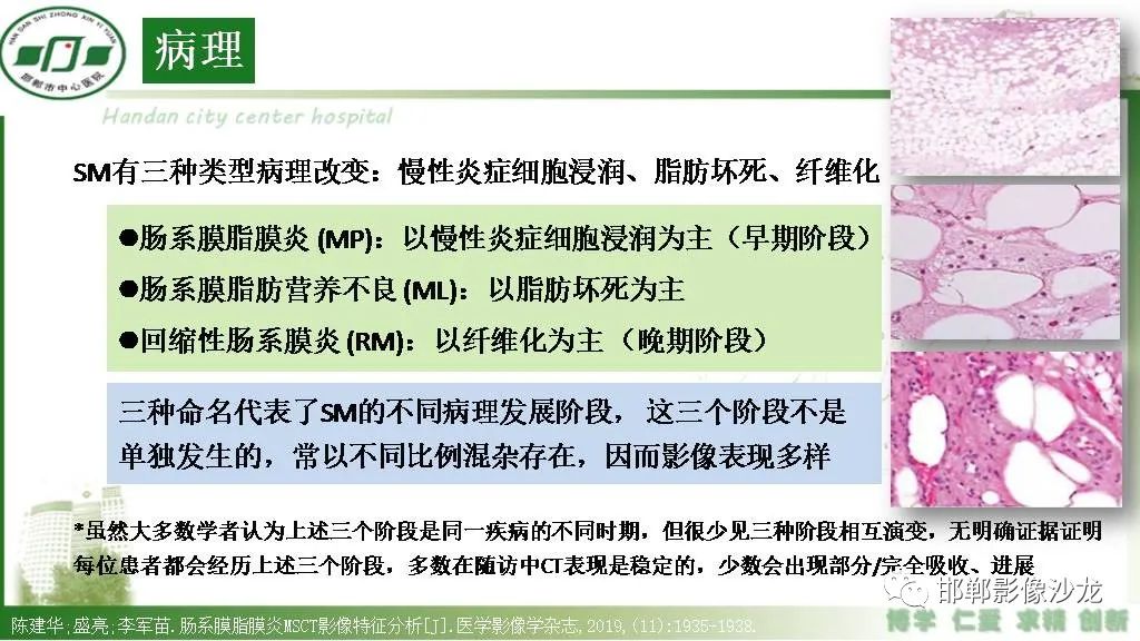 【PPT】硬化性肠系膜炎-7