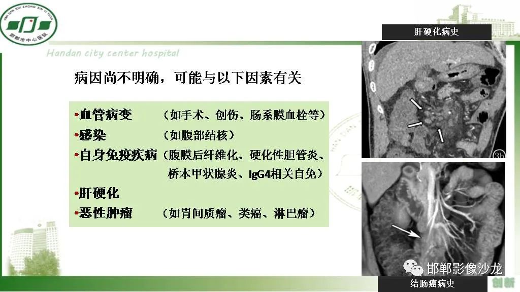 【PPT】硬化性肠系膜炎-6