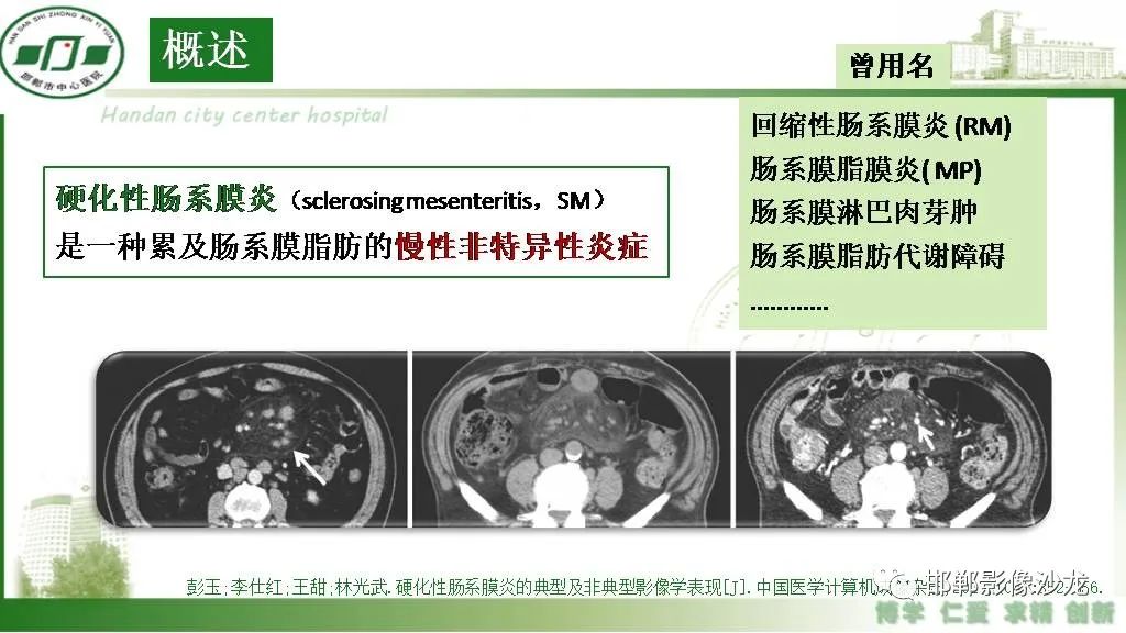 【PPT】硬化性肠系膜炎-4