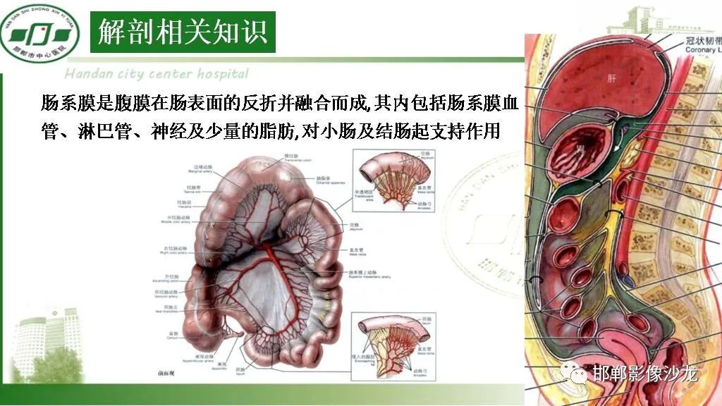【PPT】硬化性肠系膜炎-8