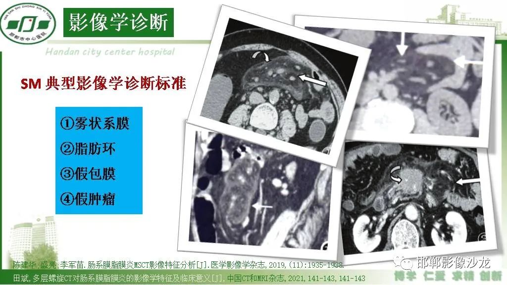 【PPT】硬化性肠系膜炎-11