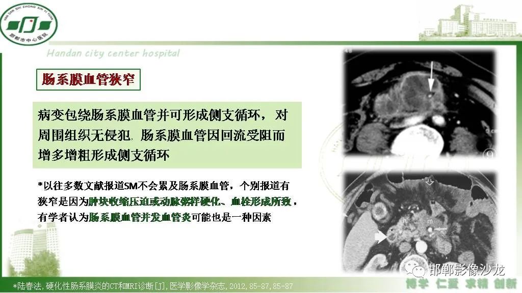 【PPT】硬化性肠系膜炎-17