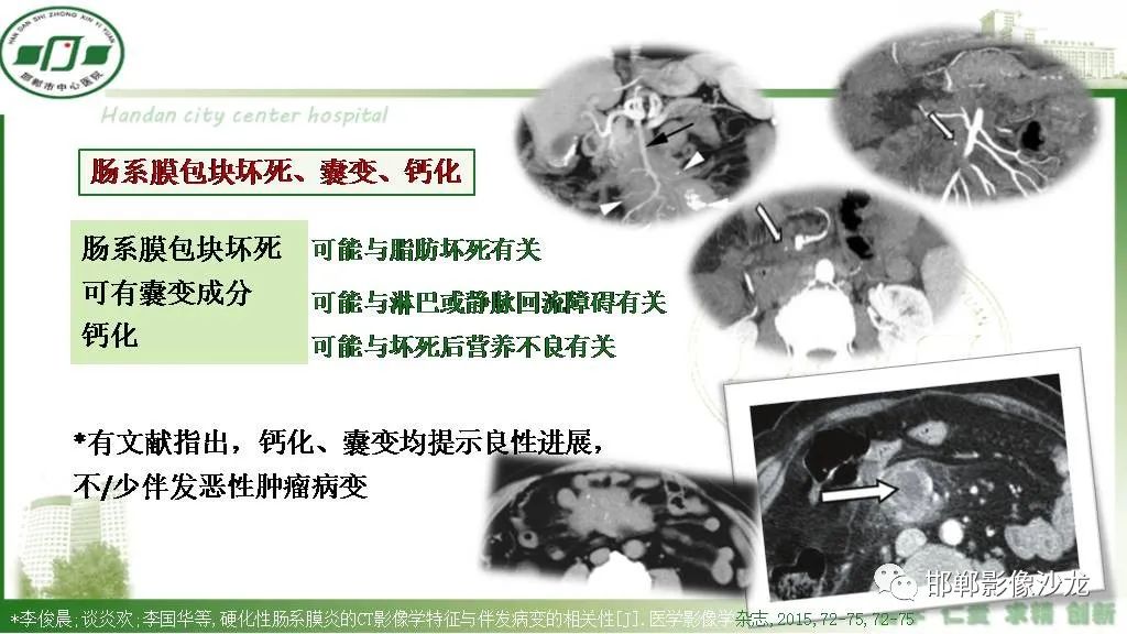 【PPT】硬化性肠系膜炎-20