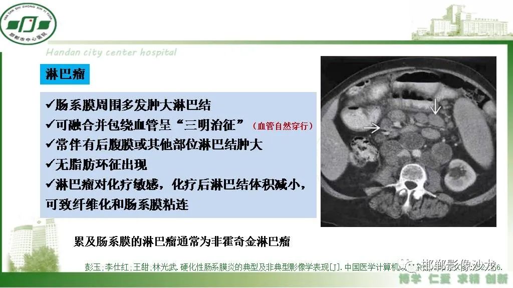 【PPT】硬化性肠系膜炎-28