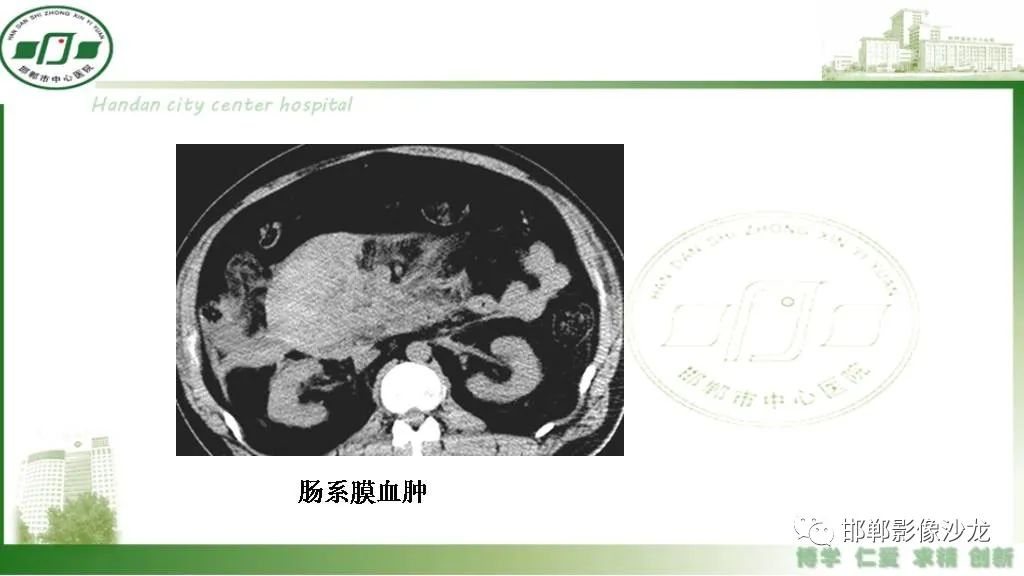 【PPT】硬化性肠系膜炎-26