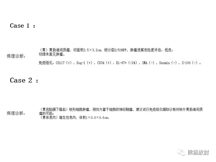 【病例】胃间质瘤VS神经鞘瘤-15