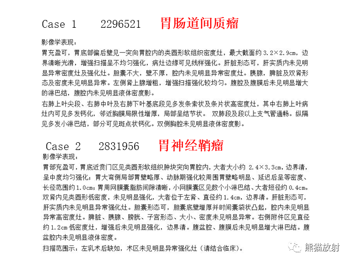 【病例】胃间质瘤VS神经鞘瘤-16