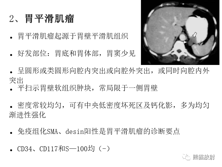 【病例】胃间质瘤VS神经鞘瘤-24