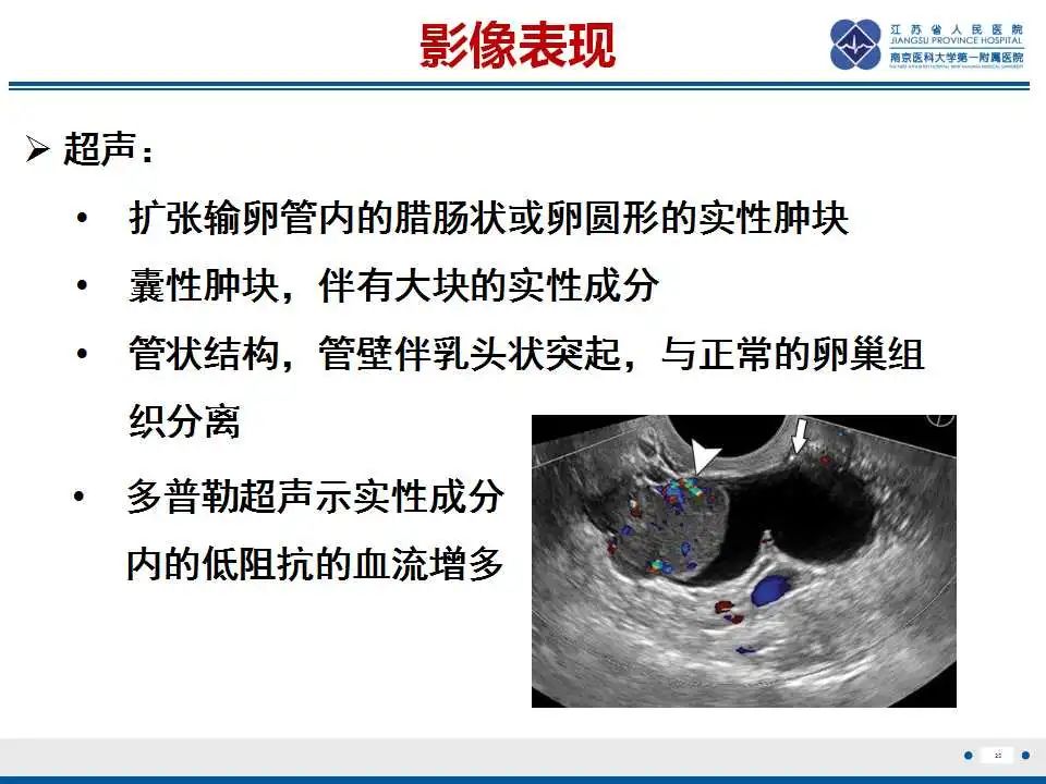 【PPT】原发性输卵管癌-26