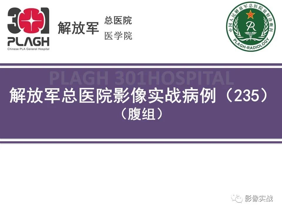 【病例】节细胞神经母细胞瘤1例CT解析思路-1