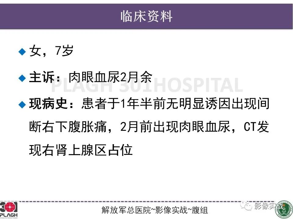 【病例】节细胞神经母细胞瘤1例CT解析思路-2