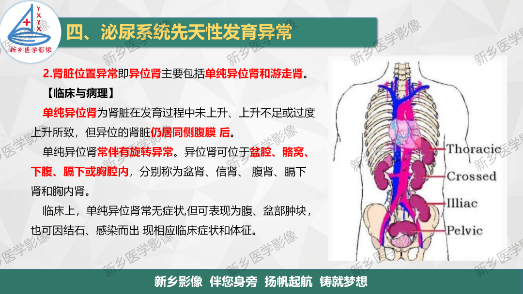 【PPT】泌尿系统先天性发育异常影像表现-5