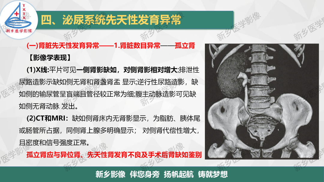 【PPT】泌尿系统先天性发育异常影像表现-4