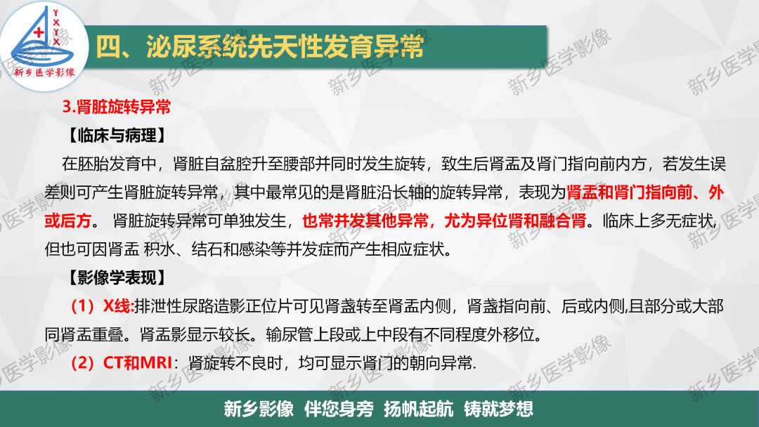 【PPT】泌尿系统先天性发育异常影像表现-11