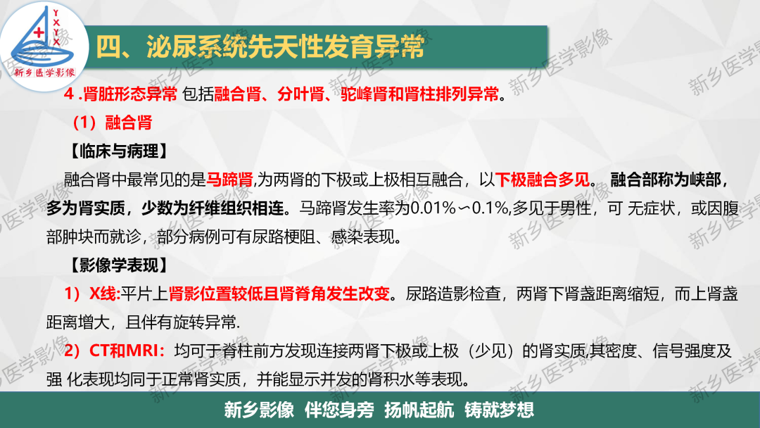 【PPT】泌尿系统先天性发育异常影像表现-16