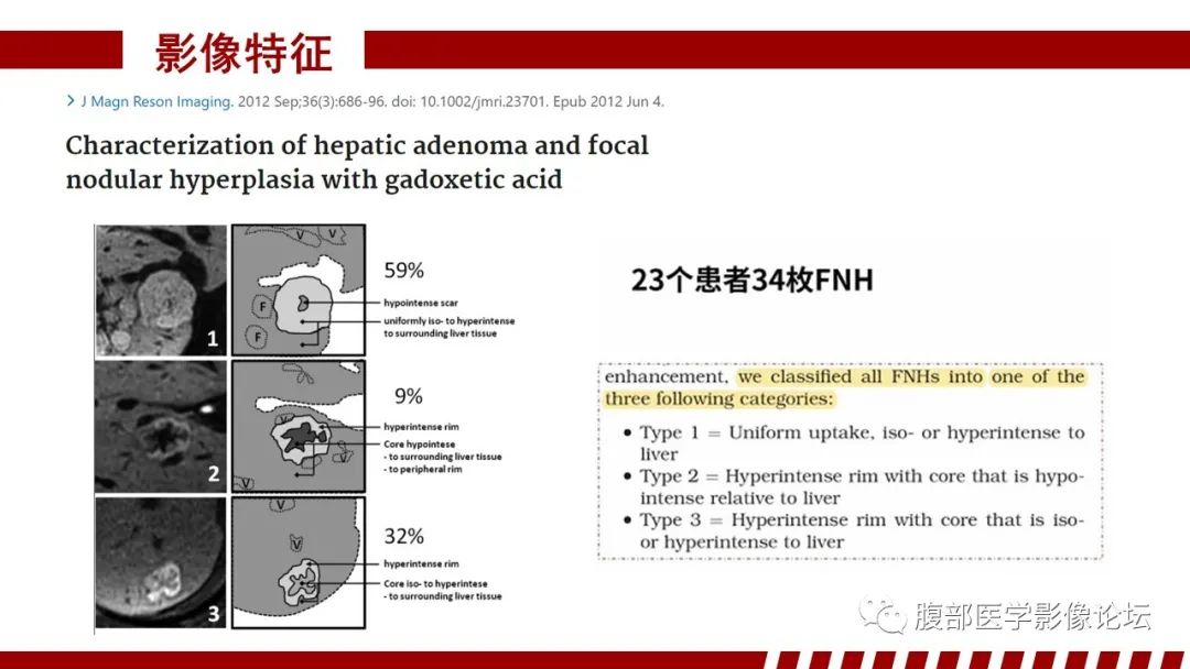 【PPT】肝胆期高信号的病变影像表现及临床意义-19