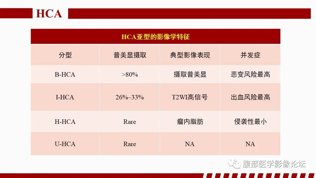 【PPT】肝胆期高信号的病变影像表现及临床意义-36