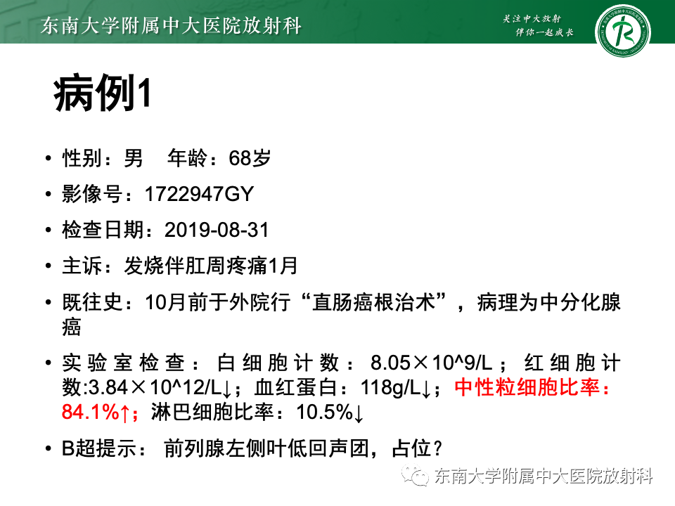 【PPT】前列腺脓肿-2