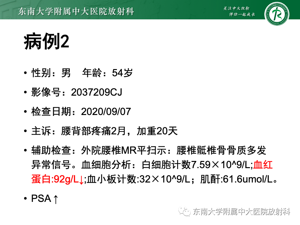 【PPT】前列腺脓肿-20