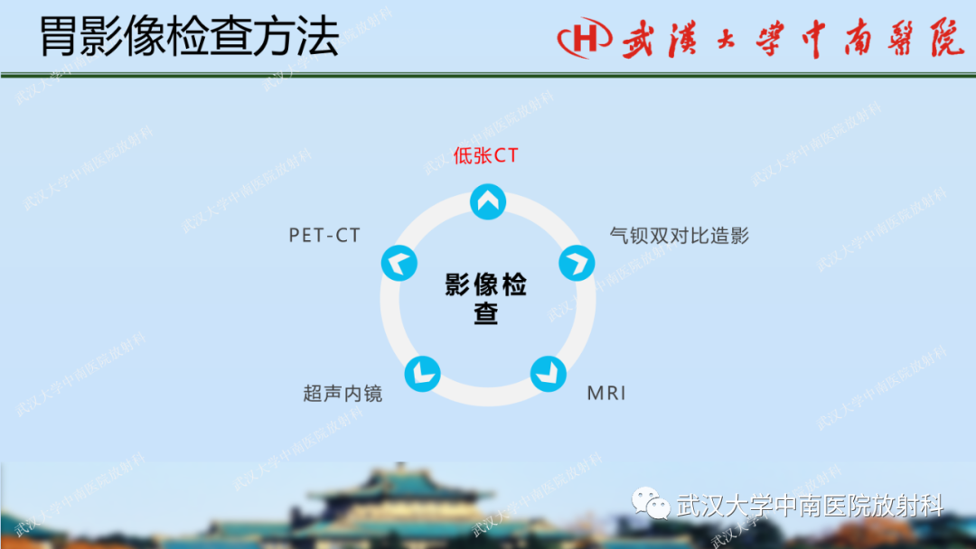 【PPT】胃占位病变影像诊断分析-4
