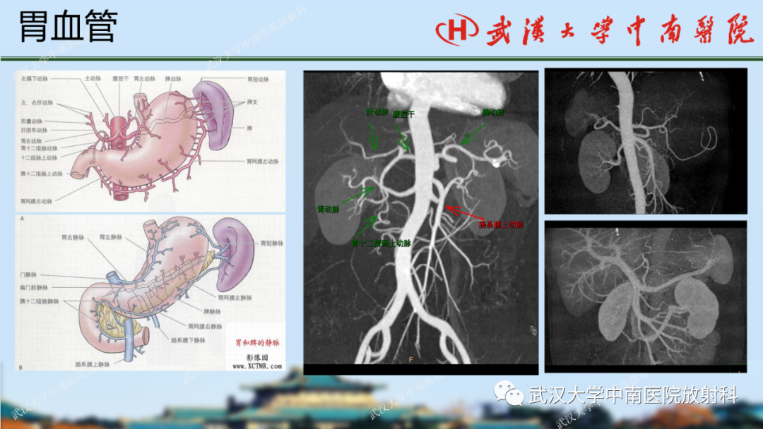 【PPT】胃占位病变影像诊断分析-7