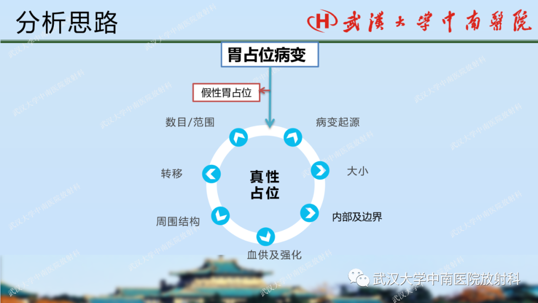 【PPT】胃占位病变影像诊断分析-16