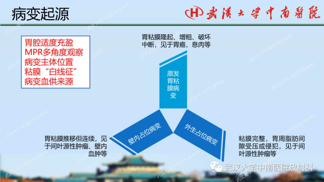 【PPT】胃占位病变影像诊断分析-21