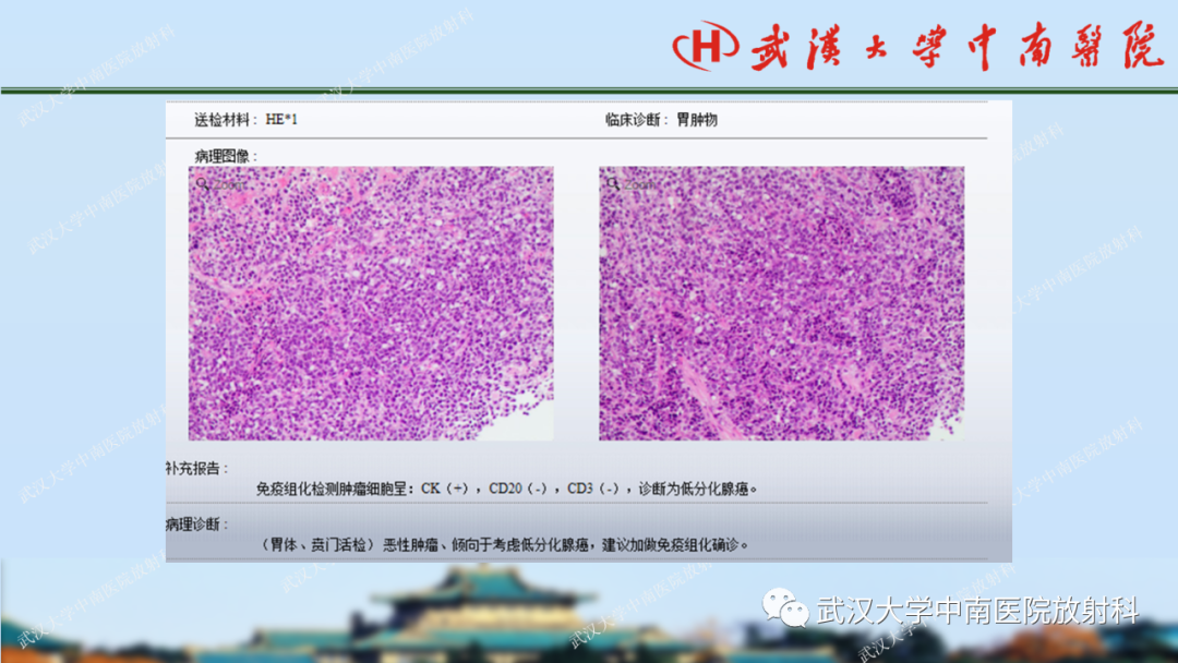 【PPT】胃占位病变影像诊断分析-59