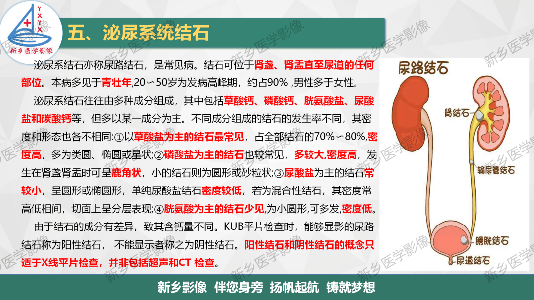 【PPT】泌尿系结石的影像表现及诊断注意事项-3
