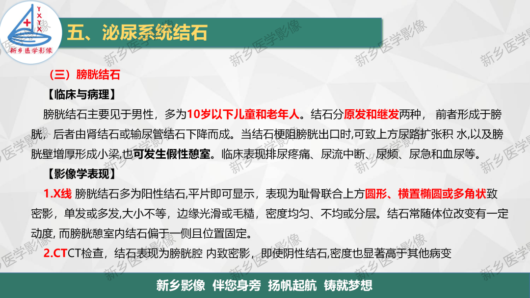 【PPT】泌尿系结石的影像表现及诊断注意事项-13