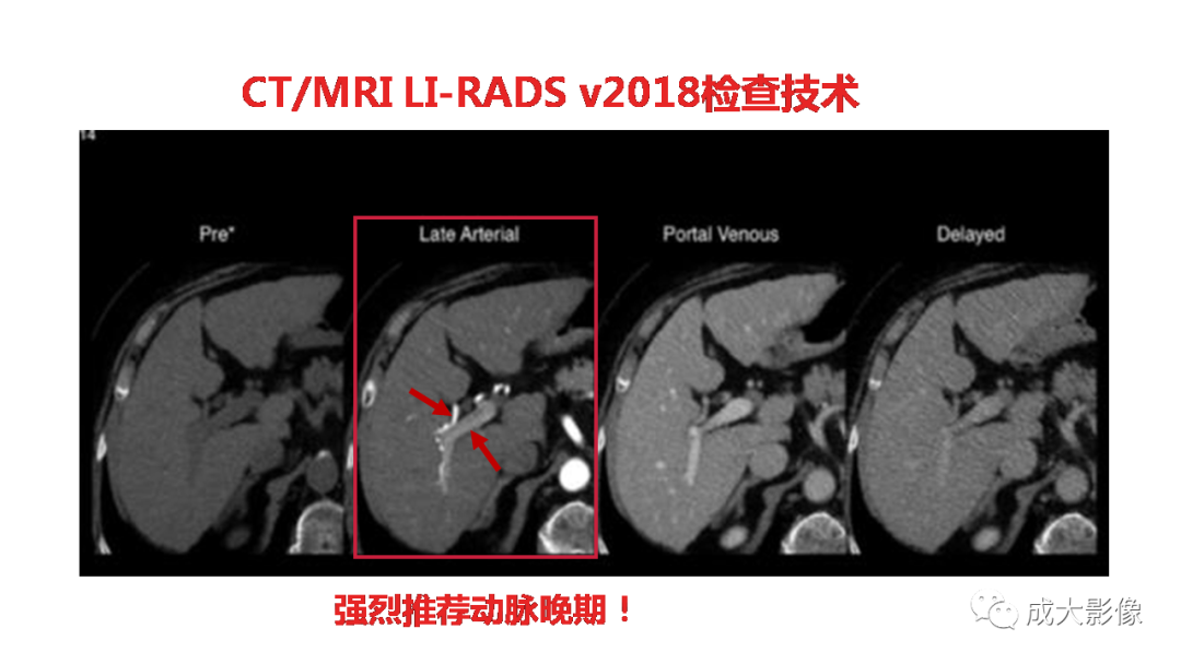 【PPT】LI-RADS结构化报告实例应用-10