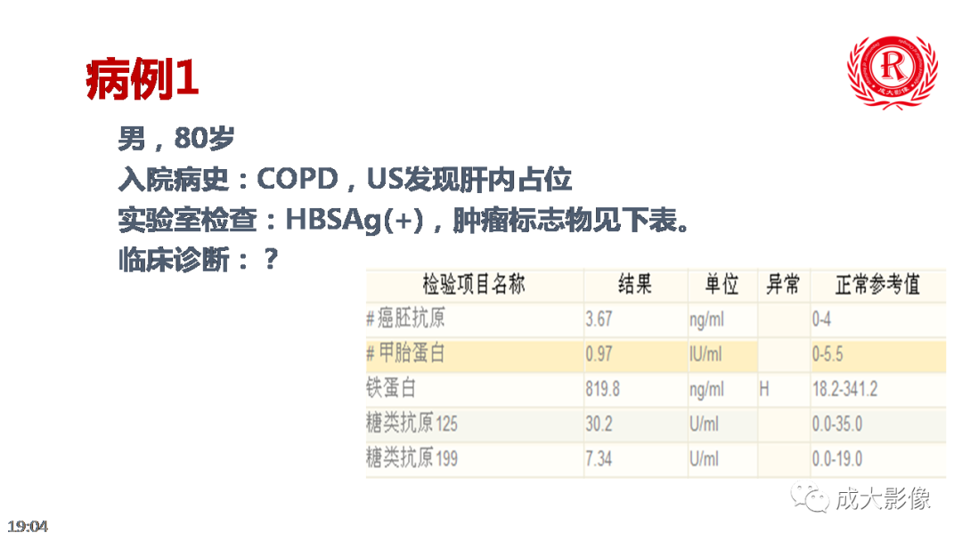 【PPT】LI-RADS结构化报告实例应用-18