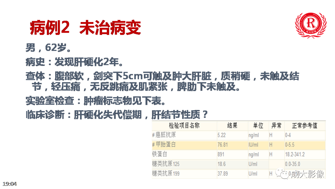 【PPT】LI-RADS结构化报告实例应用-24