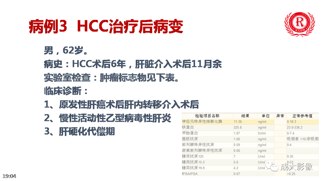 【PPT】LI-RADS结构化报告实例应用-31