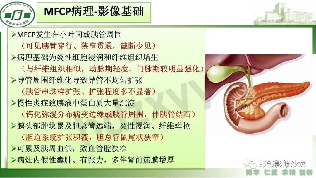 【PPT】肿块性胰腺炎-7