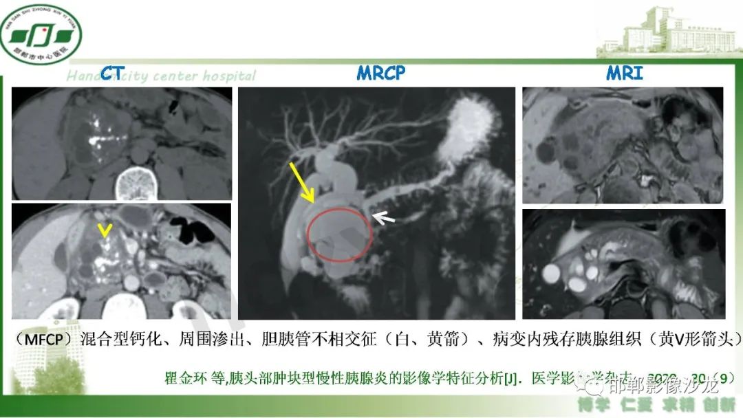 【PPT】肿块性胰腺炎-9