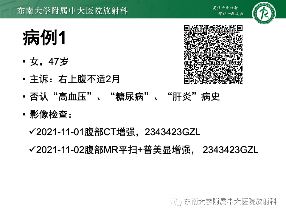 【PPT】肝细胞腺瘤-3