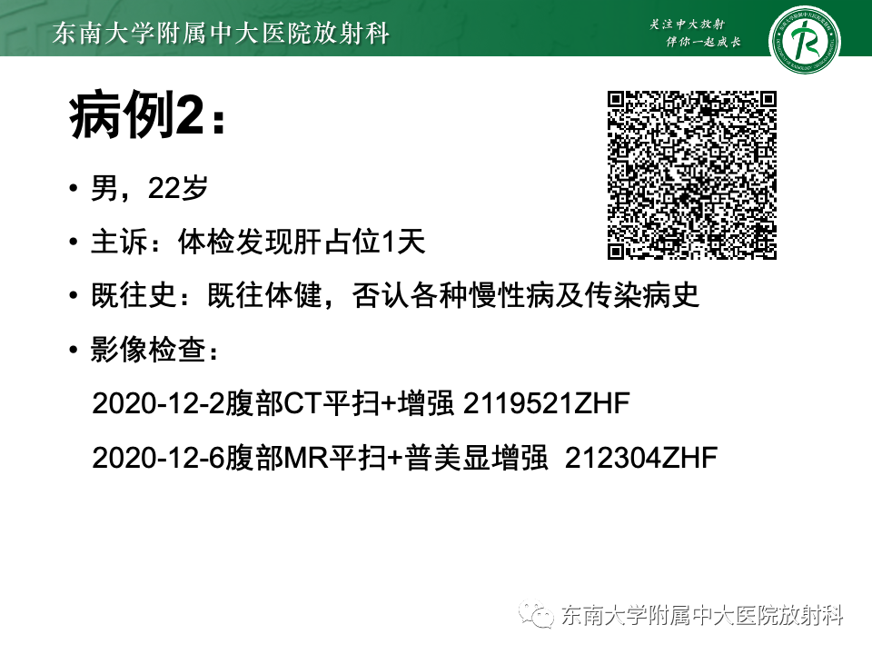 【PPT】肝细胞腺瘤-21