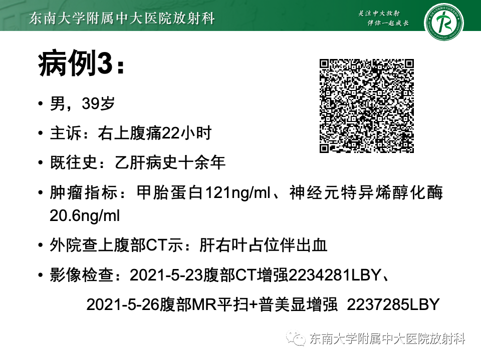 【PPT】肝细胞腺瘤-28